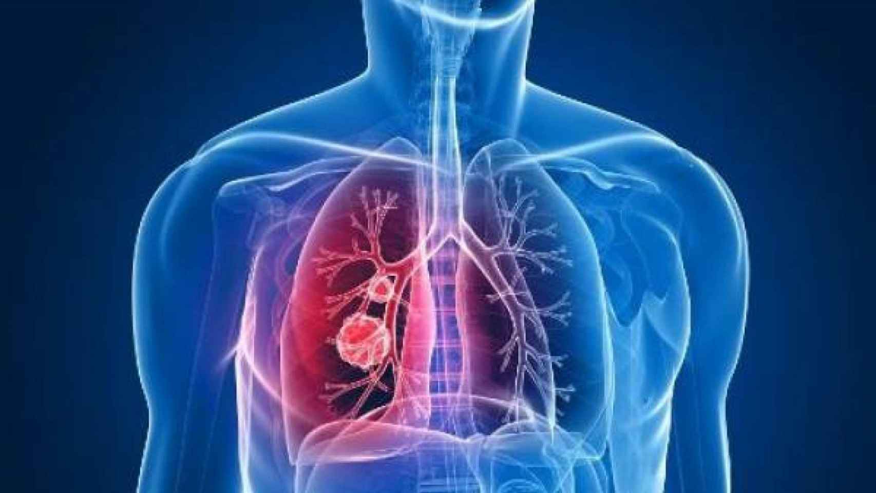 Golpe español al cáncer de pulmón: prometedora terapia sin efectos adversos